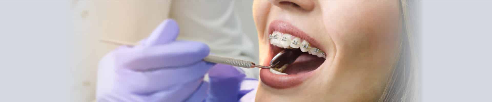 cosmetic dentistry perth