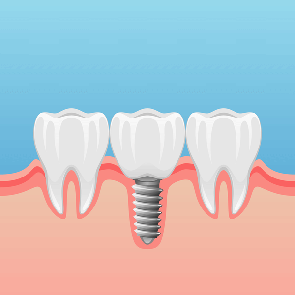 Four Common Cosmetic Dentistry Procedures To Improve Your Smile