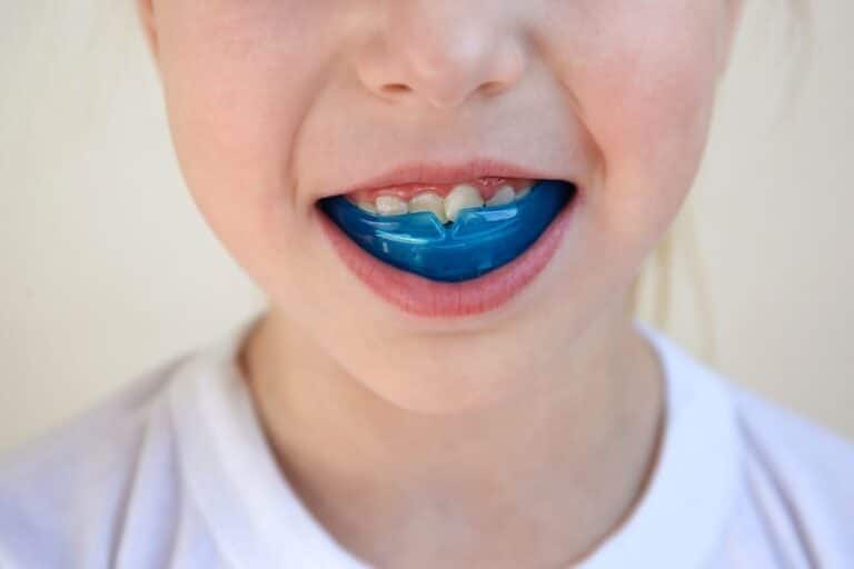 Child smiling confidently with a mouth guard, highlighting the significance of dental protection during sports activities