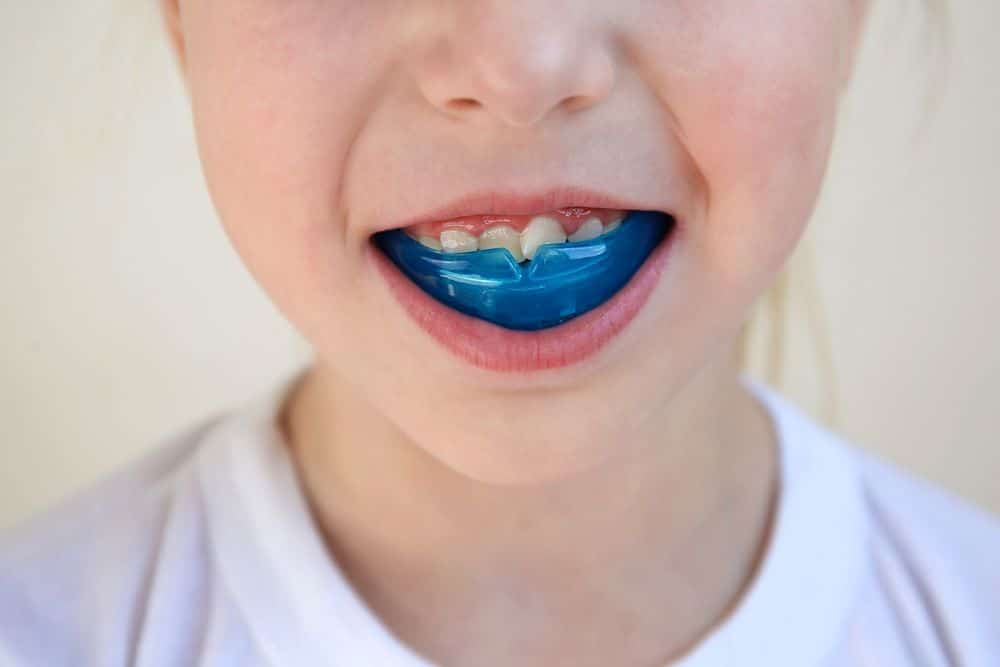 The Importance of Mouth Guards in Preventing Dental Trauma During Sports